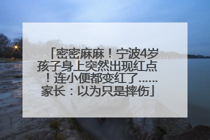 密密麻麻！宁波4岁孩子身上突然出现红点！连小便都变红了……家长：以为只是摔伤