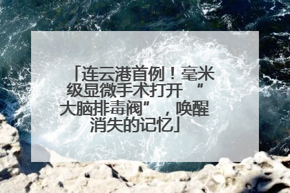 连云港首例！毫米级显微手术打开 “大脑排毒阀”，唤醒消失的记忆